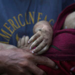 Middle East: Gaza, 8 deaths from starvation in 24 hours, including 2 children, 281 since the start of the war