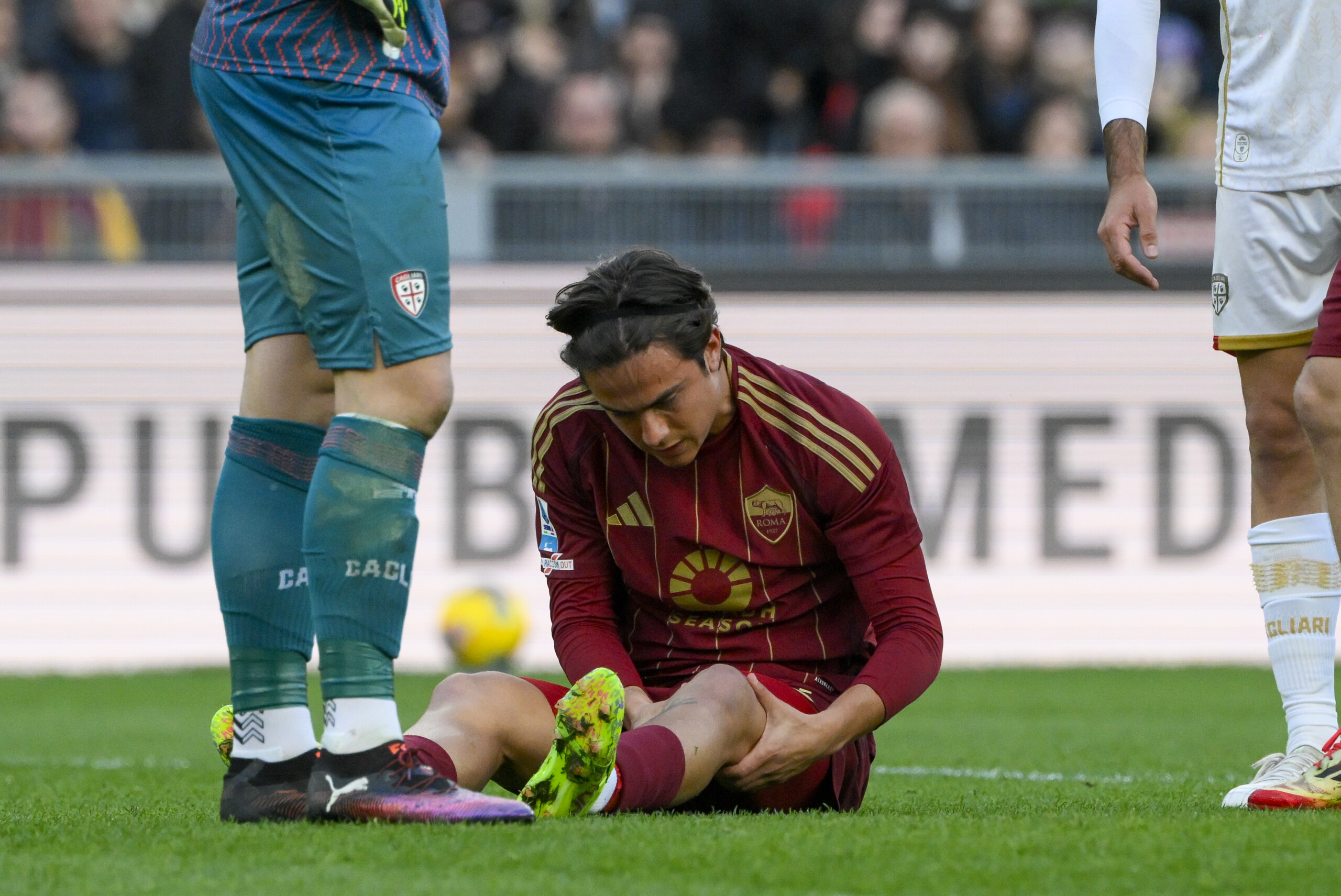 Roma, Dybala to undergo surgery for tendon injury