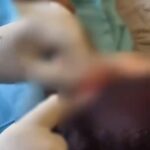 Rome: doctor suspended from practice caught performing plastic surgery