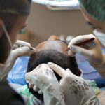 Turkey, feels ill during hair transplant: 38-year-old British man dies