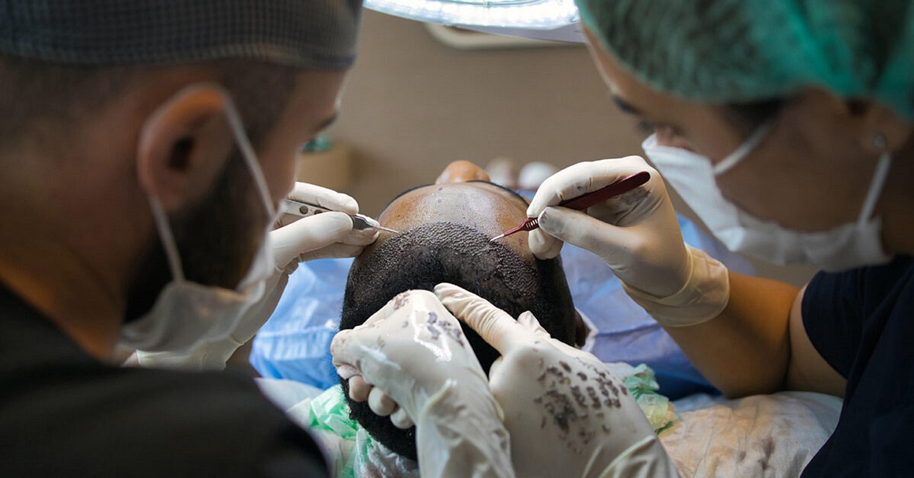 Turkey, feels ill during hair transplant: 38-year-old British man dies Turkey, feels ill during hair transplant: 38-year-old British man dies