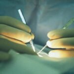 Health, heart from Athens to Turin for transplant without ever stopping beating