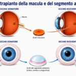 Turin: Patient regains sight following eye-to-eye transplant – a world first